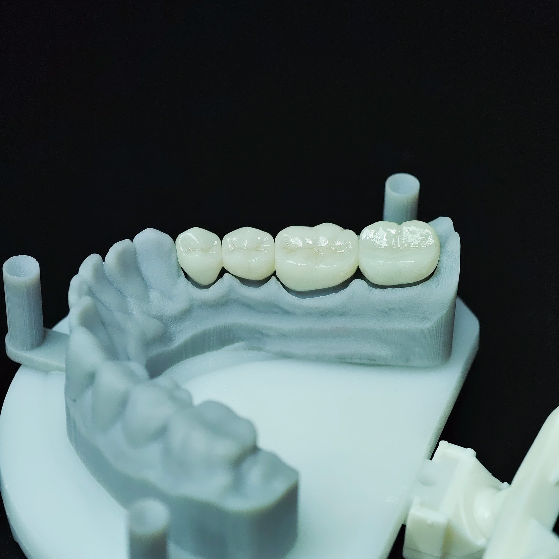 High - Strength Zirconia Crowns