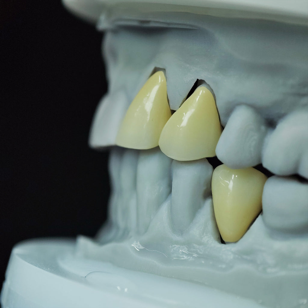 High - Strength Zirconia Crowns
