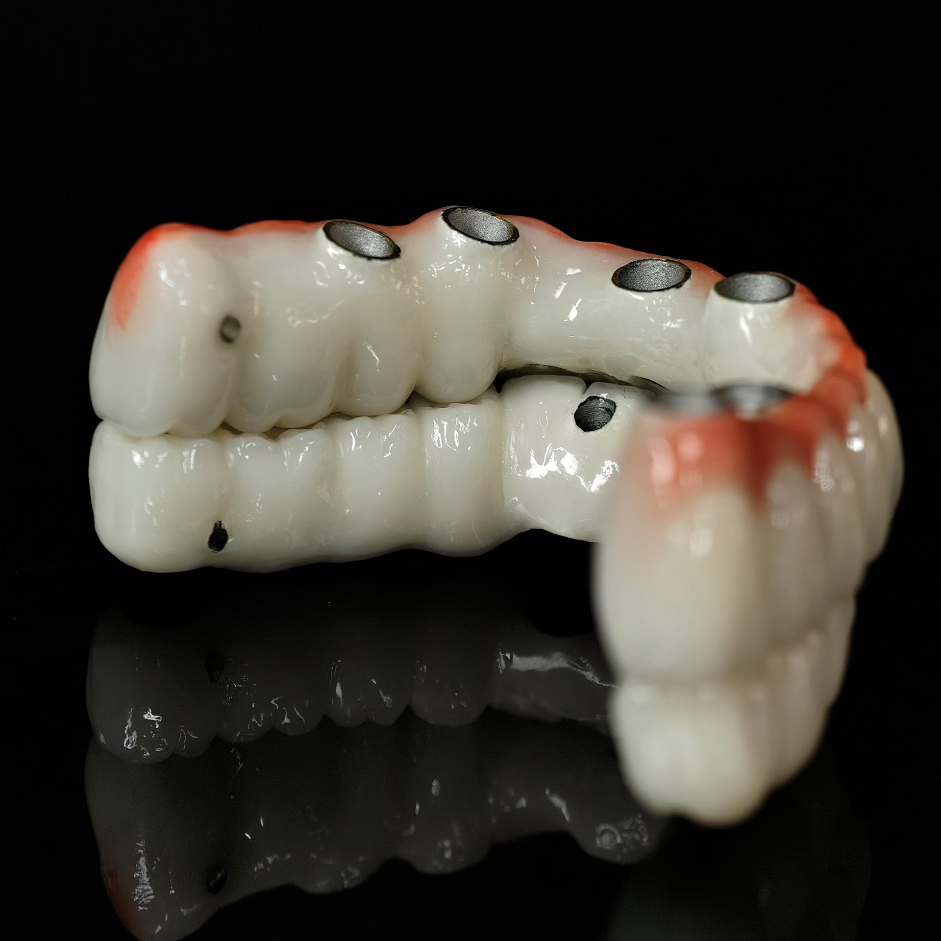 Implant-supported Co - Cr PFM Dental Bridge