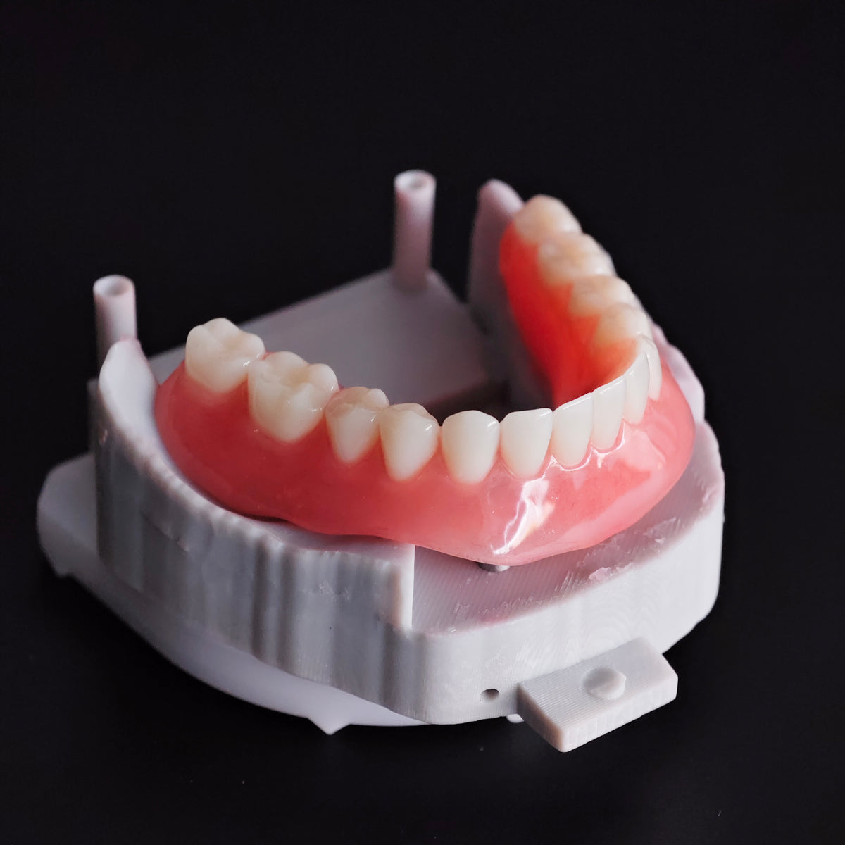 Locator Overdenture Implant Acrylic Denture Restoration
