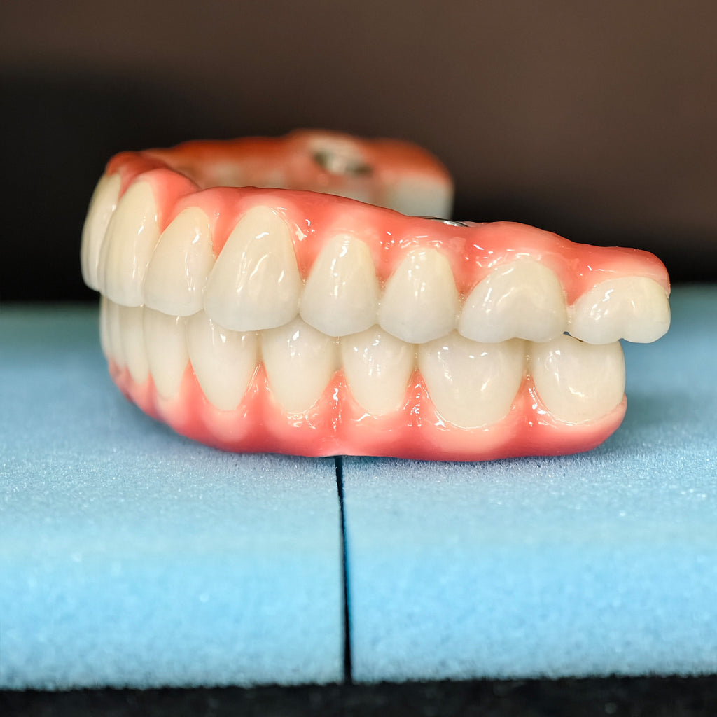Malo Bridge Implant Restorations