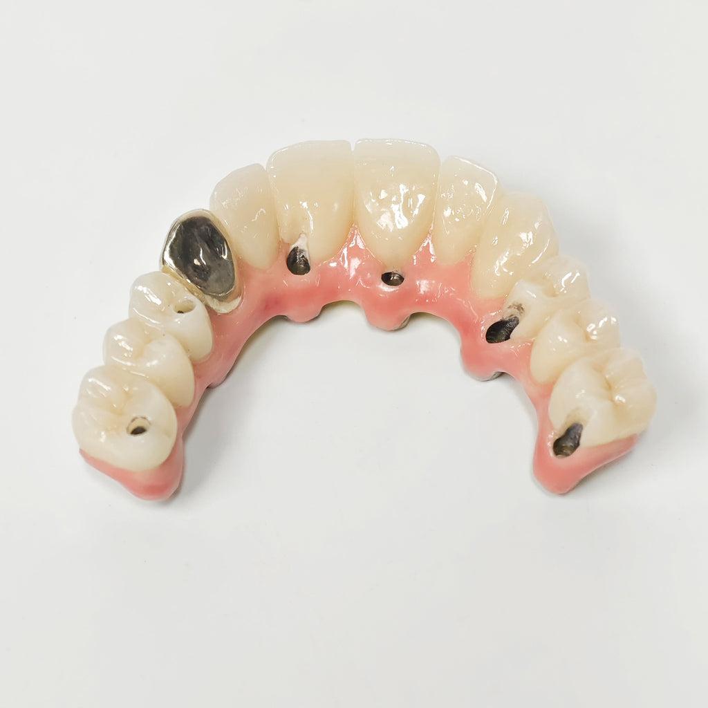 Malo Bridge With Gold-Plated Titanium Framework And A Gold Crown