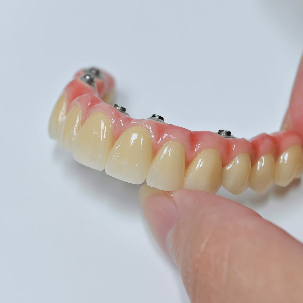 Malo Bridge With Screw-Retained