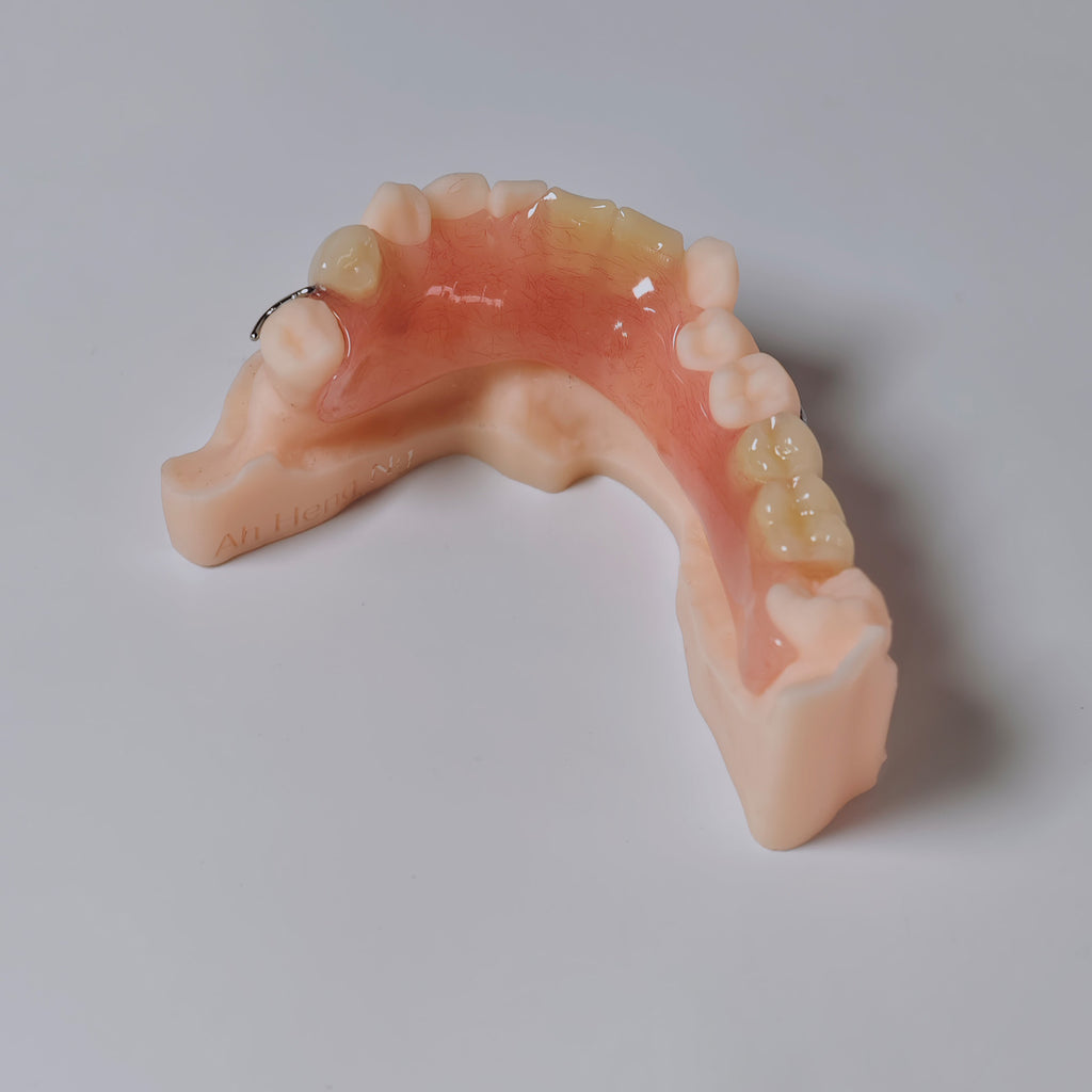 Metal Clasp Partial Denture