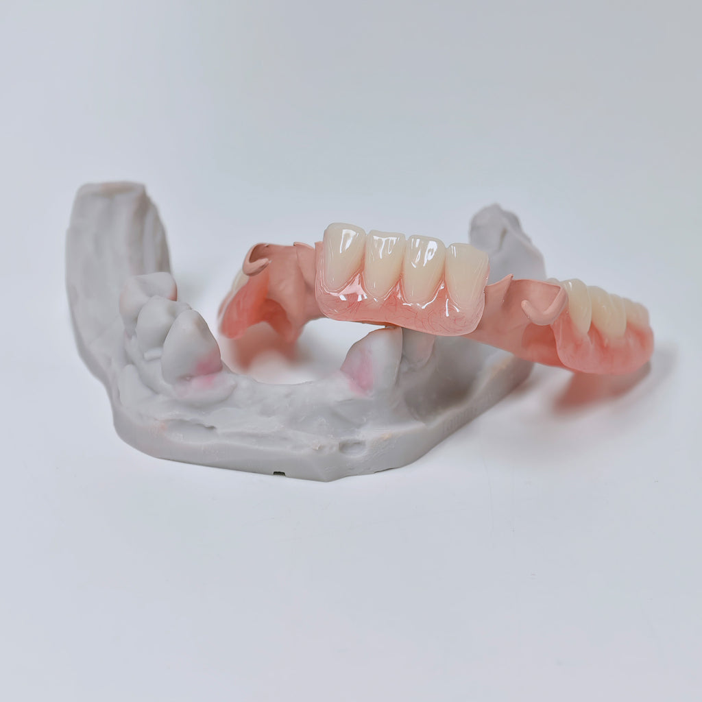 PEEK Framework Denture Metal Framework With Acrylic Denture