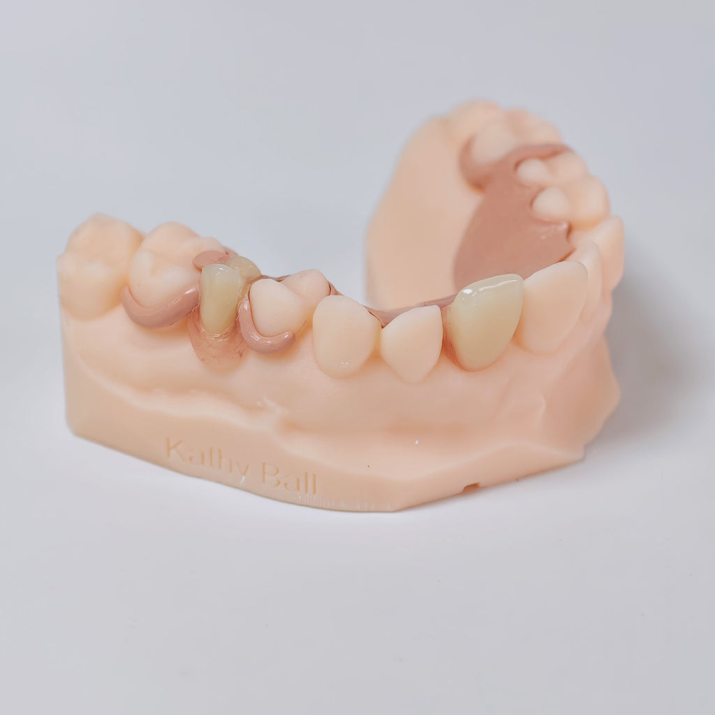 PEEK Framework Denture Metal Framework With Acrylic Denture