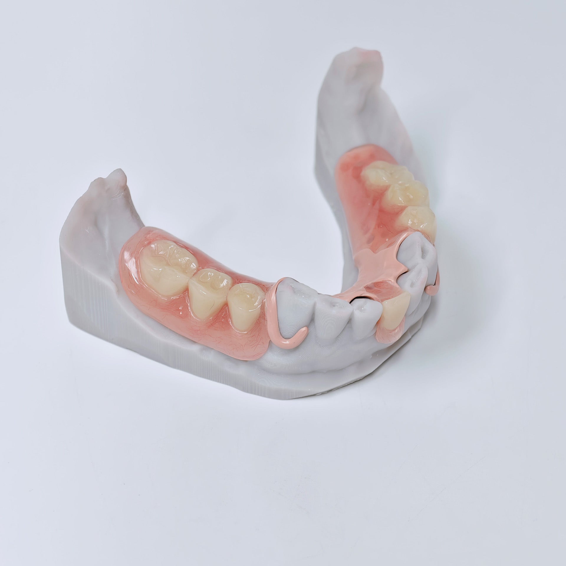PEEK Framework Denture Metal Framework With Acrylic Denture