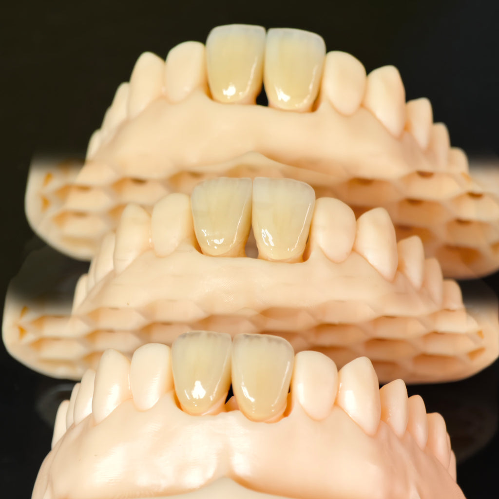 PFZ Crowns Aesthetic Shape Natural Shade Dental Crown