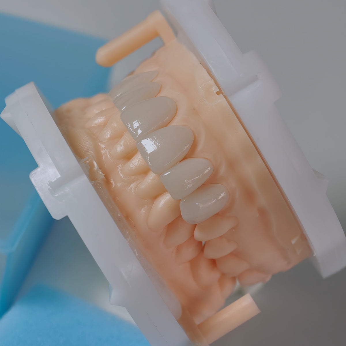 PFZ Porcelain Fused Zirconia Aidite Zirconia