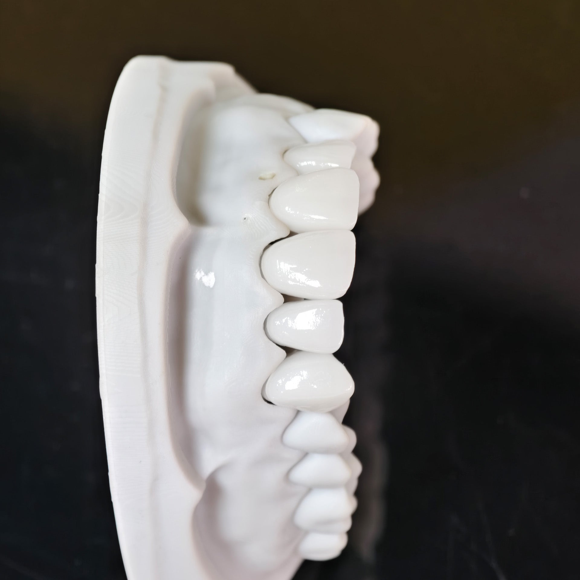 PFZ Porcelain Fused Zirconia Aidite Zirconia