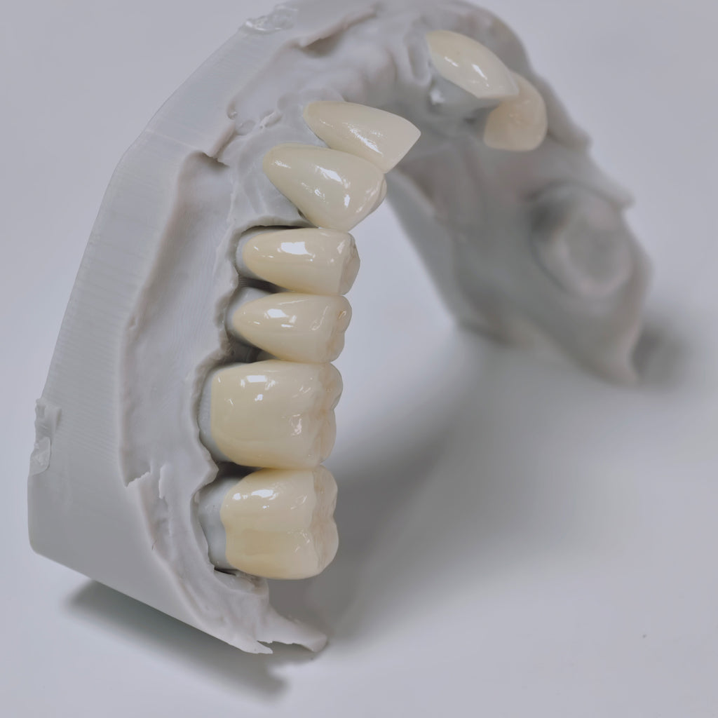 PFZ Porcelain Fused Zirconia Aidite Zirconia