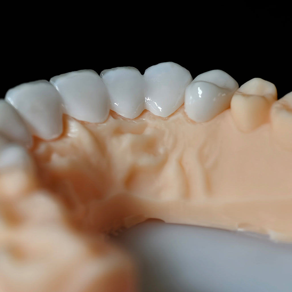 PFZ Porcelain Fused Zirconia Aidite Zirconia