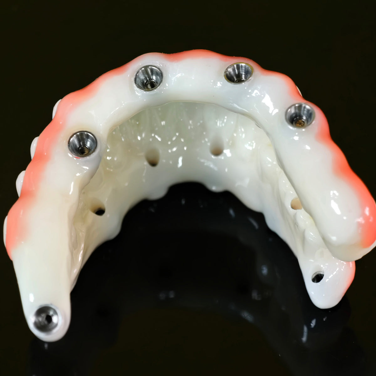 PMMA Bridge With Ti-Base Screw Retained Trying For Full Arch Restoration