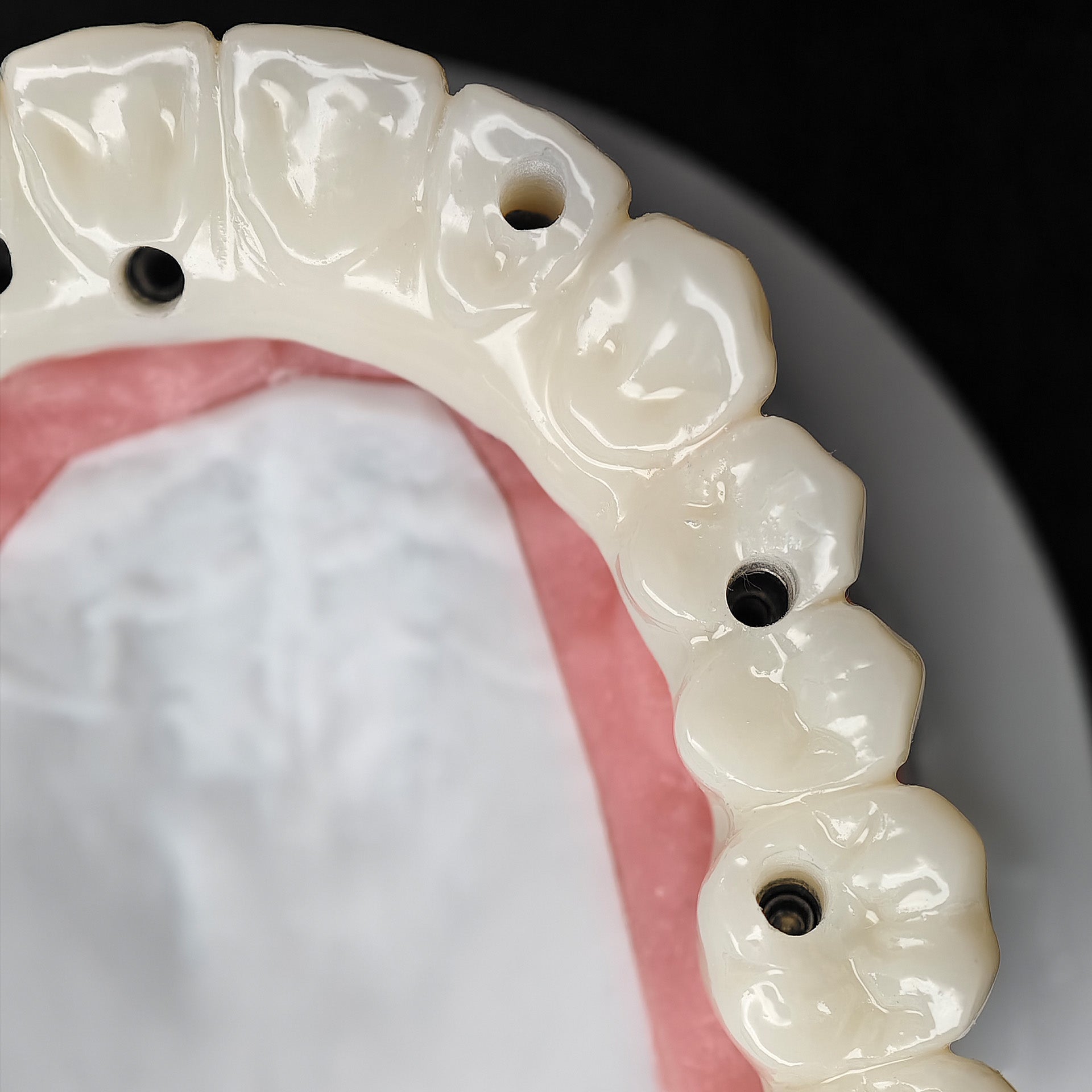 PMMA Bridge With Ti-Base Screw Retained Trying For Full Arch Restoration