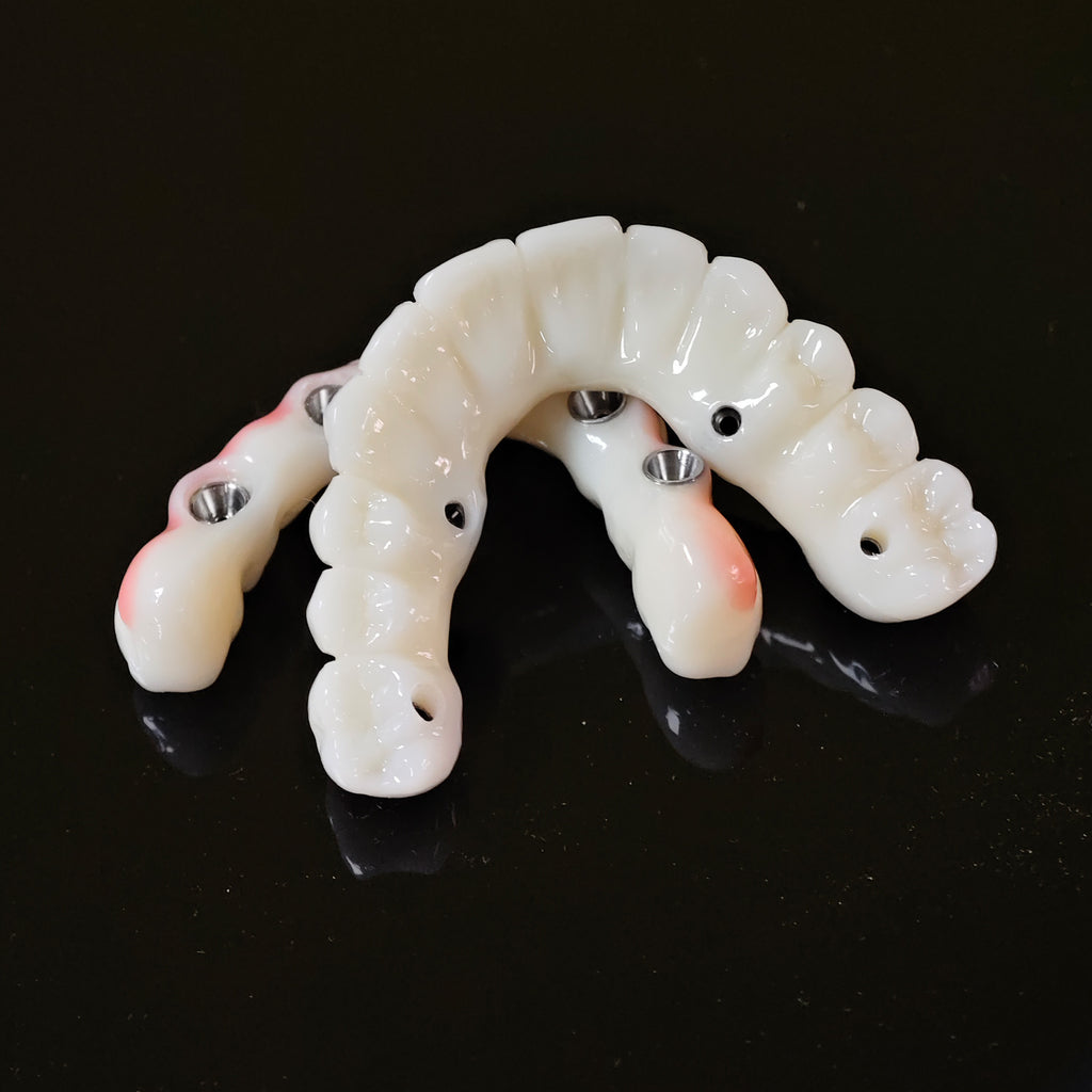 PMMA Bridge With Ti-Base Screw Retained Trying For Full Arch Restoration