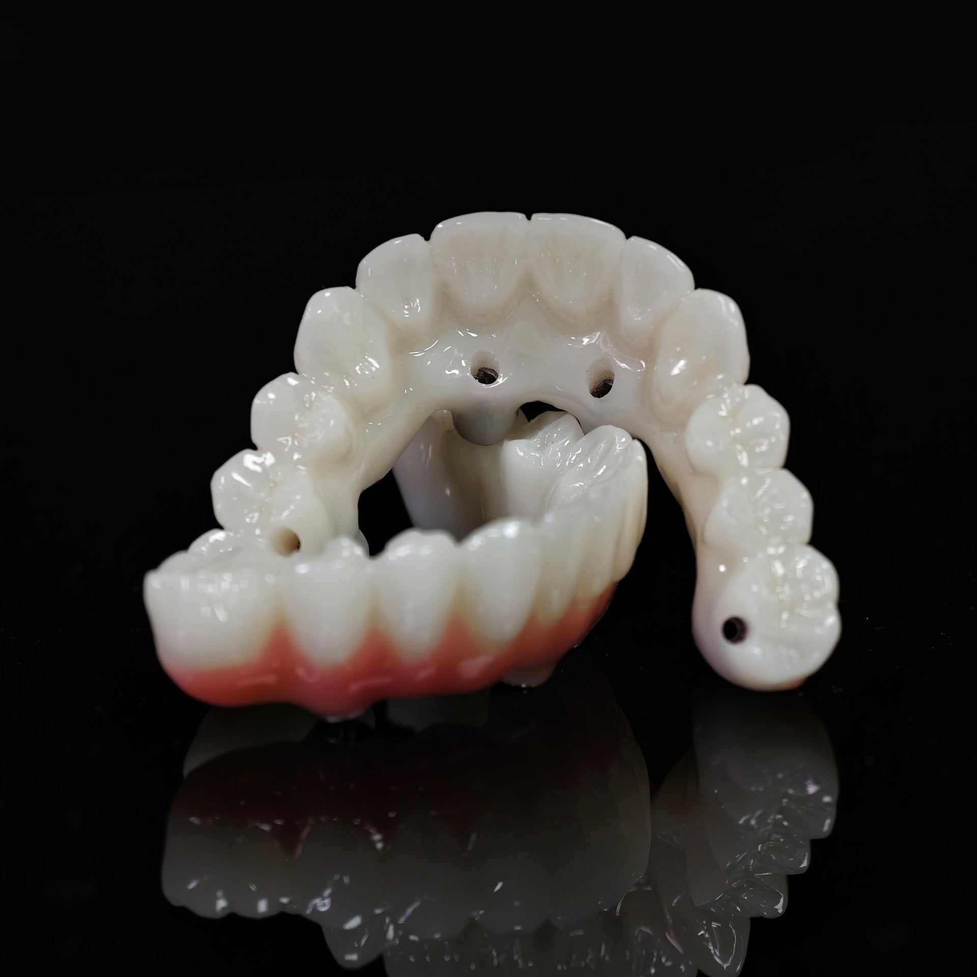PMMA Bridge With Ti-Base Screw Retained Trying For Full Arch Restoration