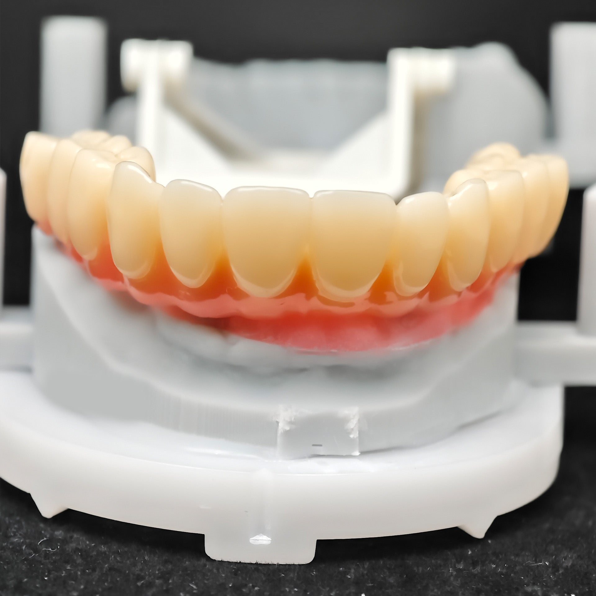 PMMA Bridge With Ti-Base Screw Retained Trying For Full Arch Restoration