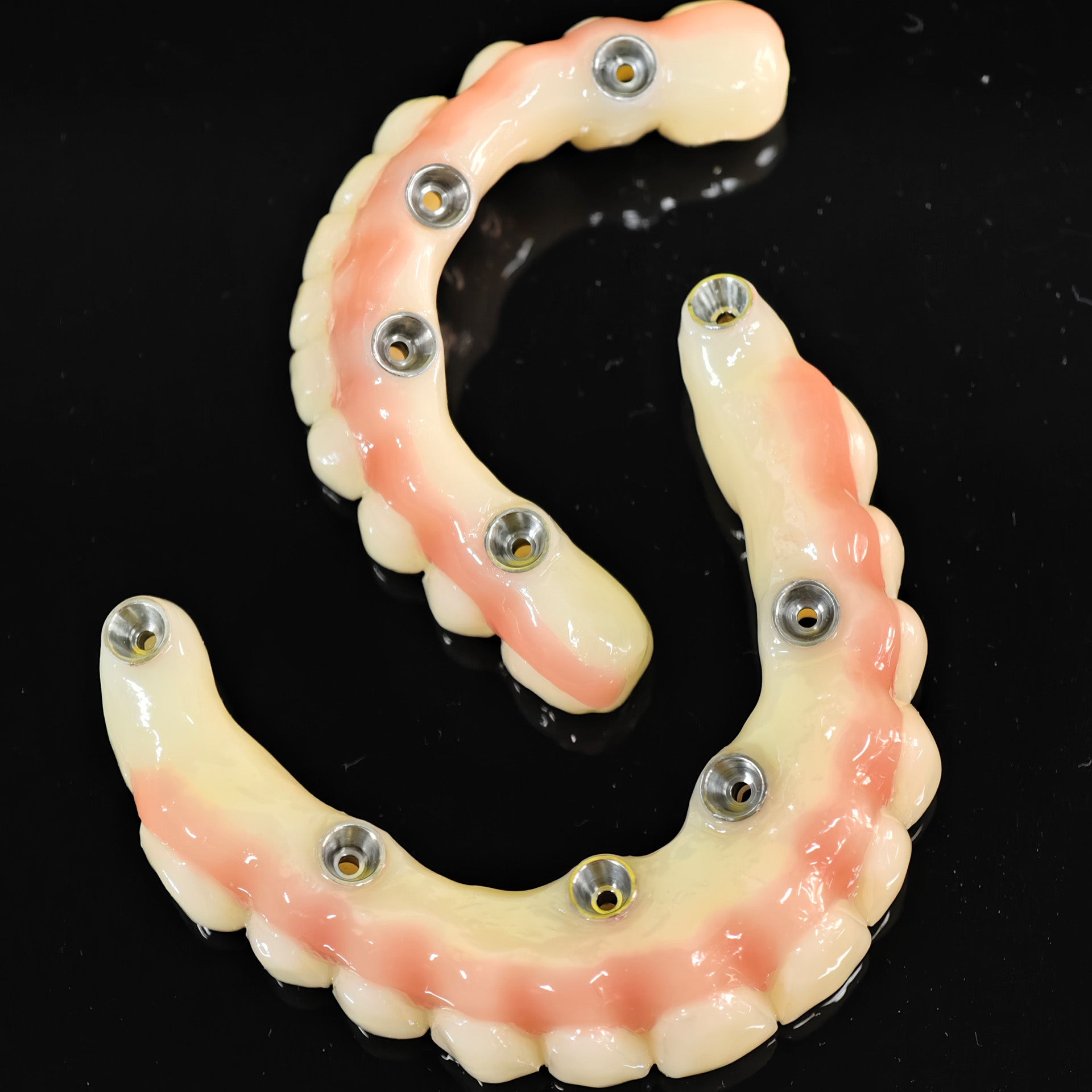 PMMA Bridge With Ti-Base Screw Retained Trying For Full Arch Restoration