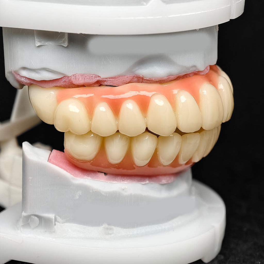 PMMA Bridge With Ti-Base Screw Retained Trying For Full Arch Restoration