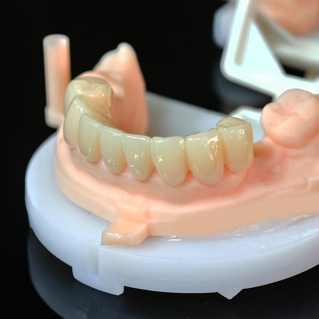 PMMA Bridge With Open Shell Preparing For Full Arch Dental Implants