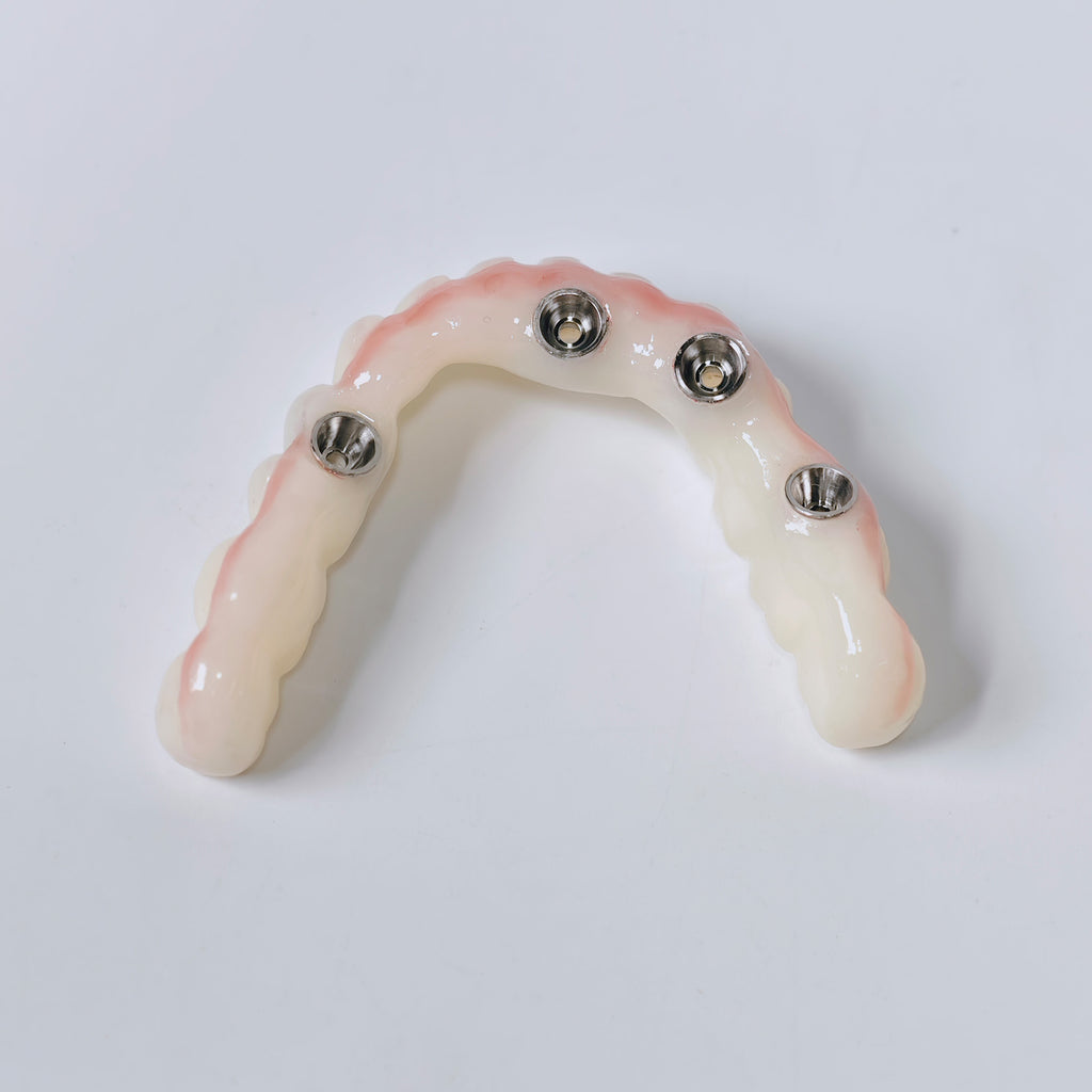 PMMA Bridge With Screw Retained