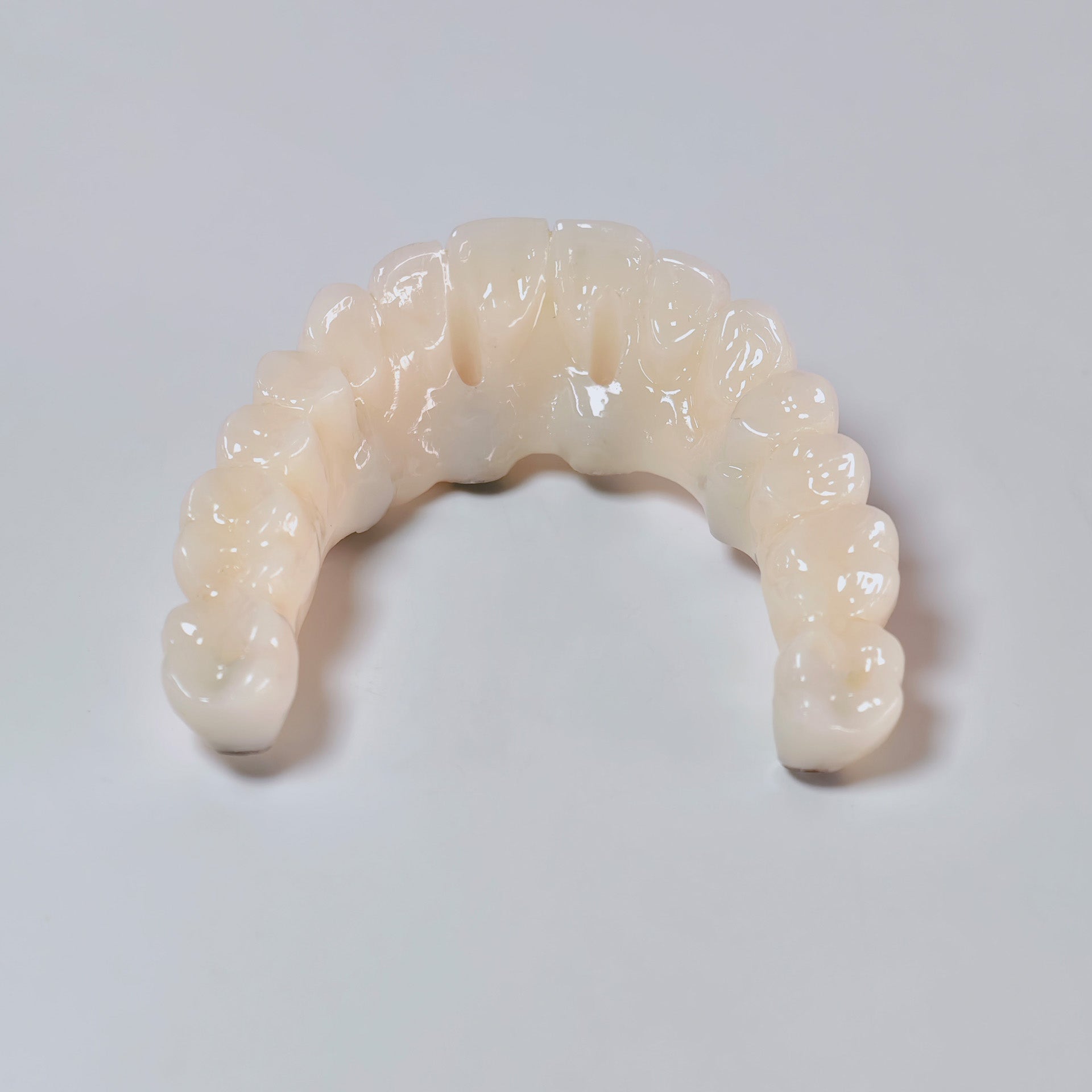 PMMA Bridge With Screw Retained