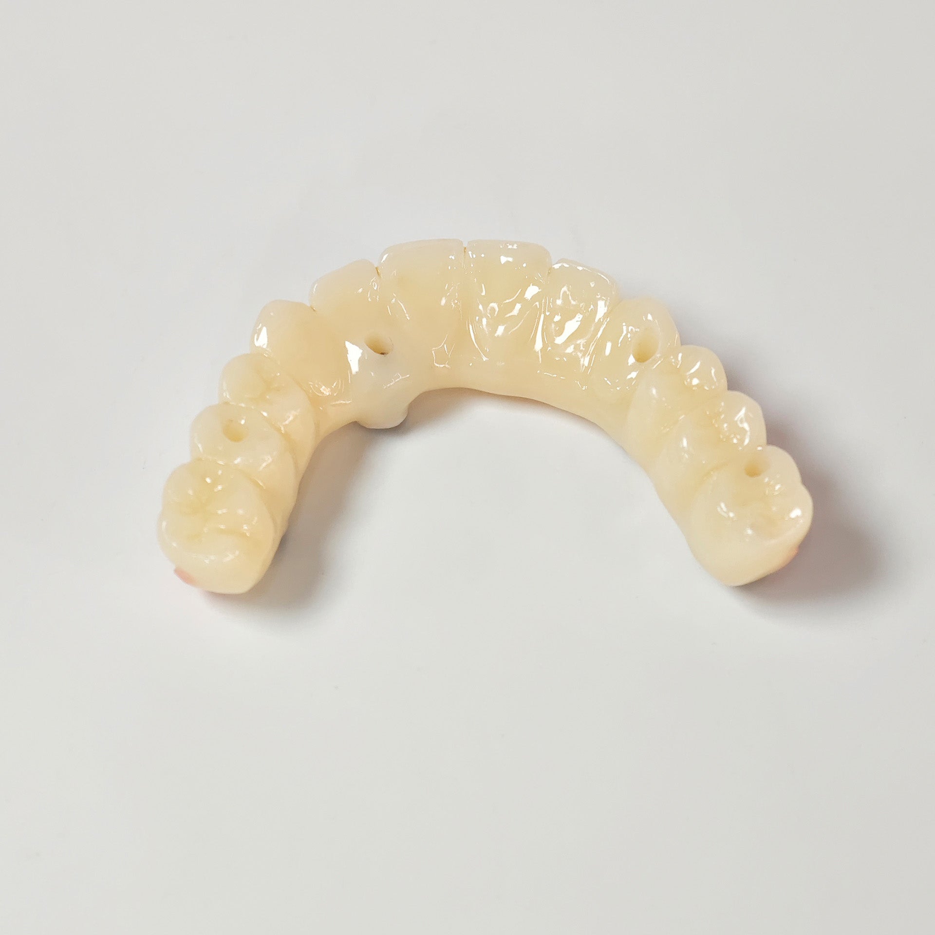 PMMA Bridge With Screw Retained