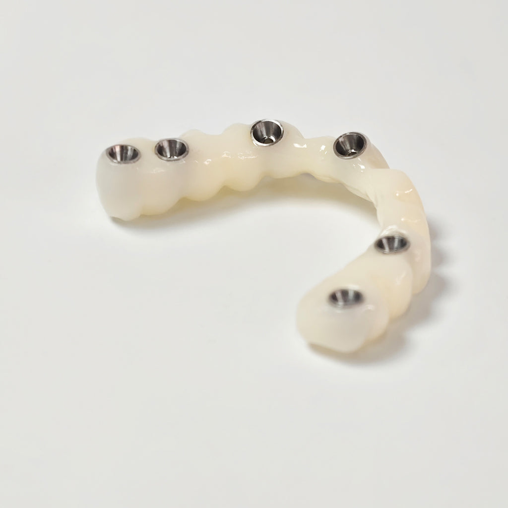 PMMA Bridge With Screw Retained