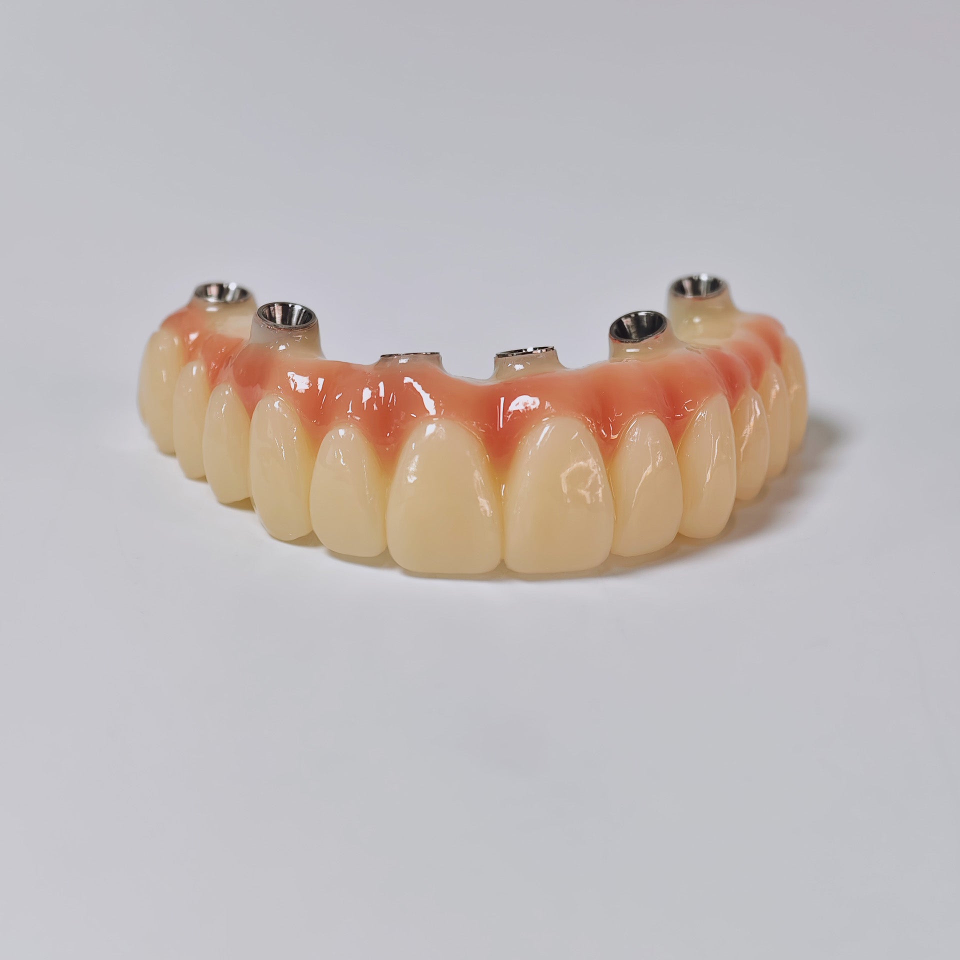PMMA Bridge With Screw Retained