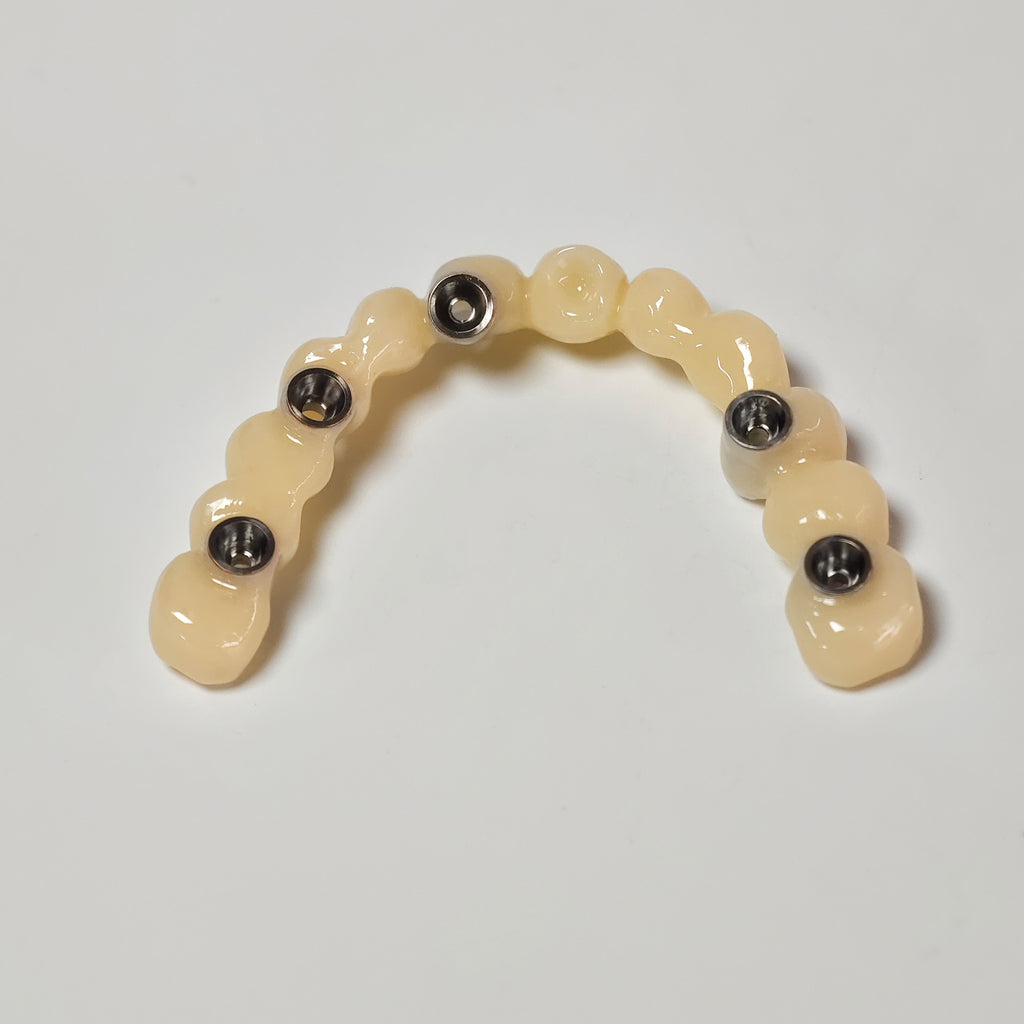 PMMA Bridge With Screw Retained