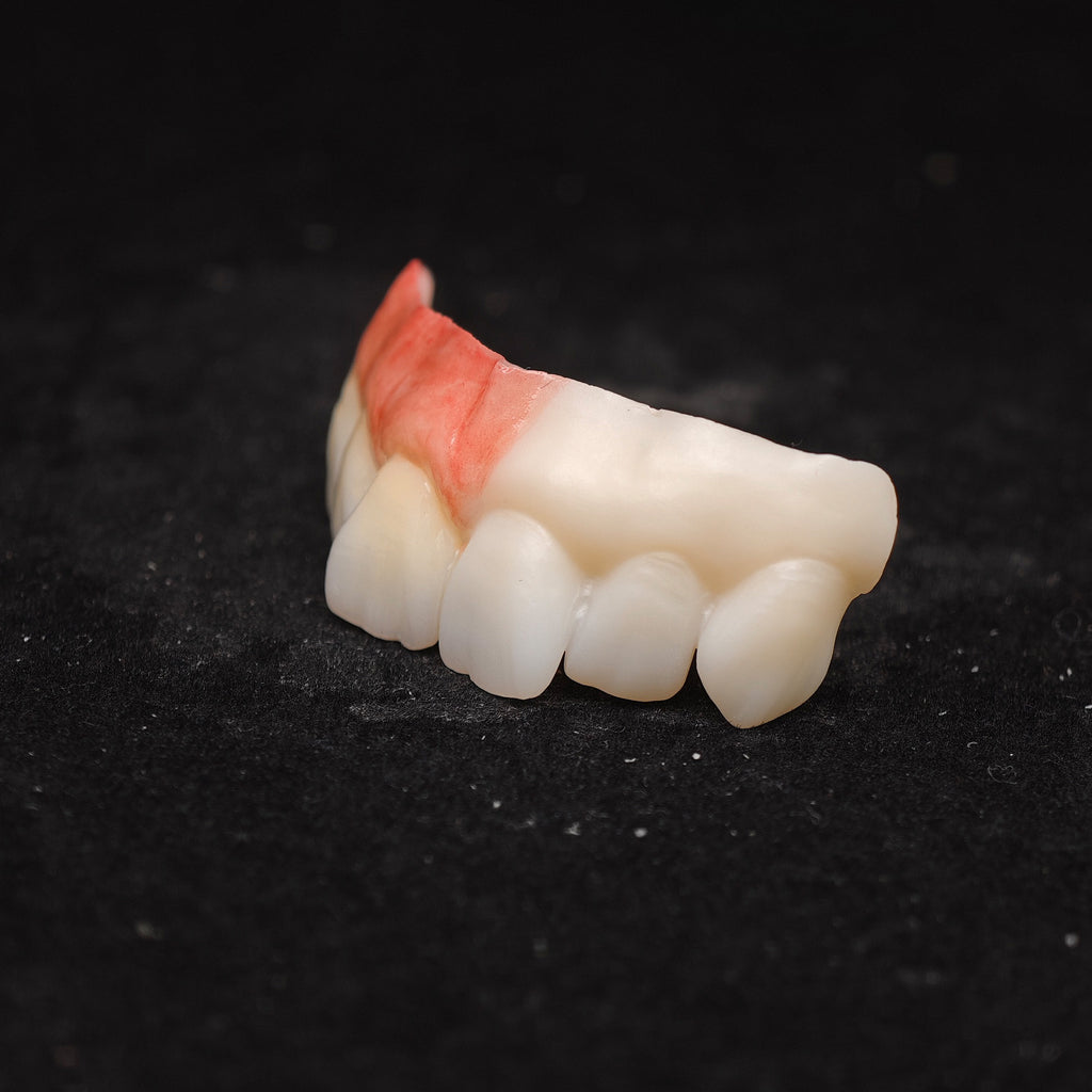 Ti-Bar Pure Titanium Metal Frame With Zirconia Bridge