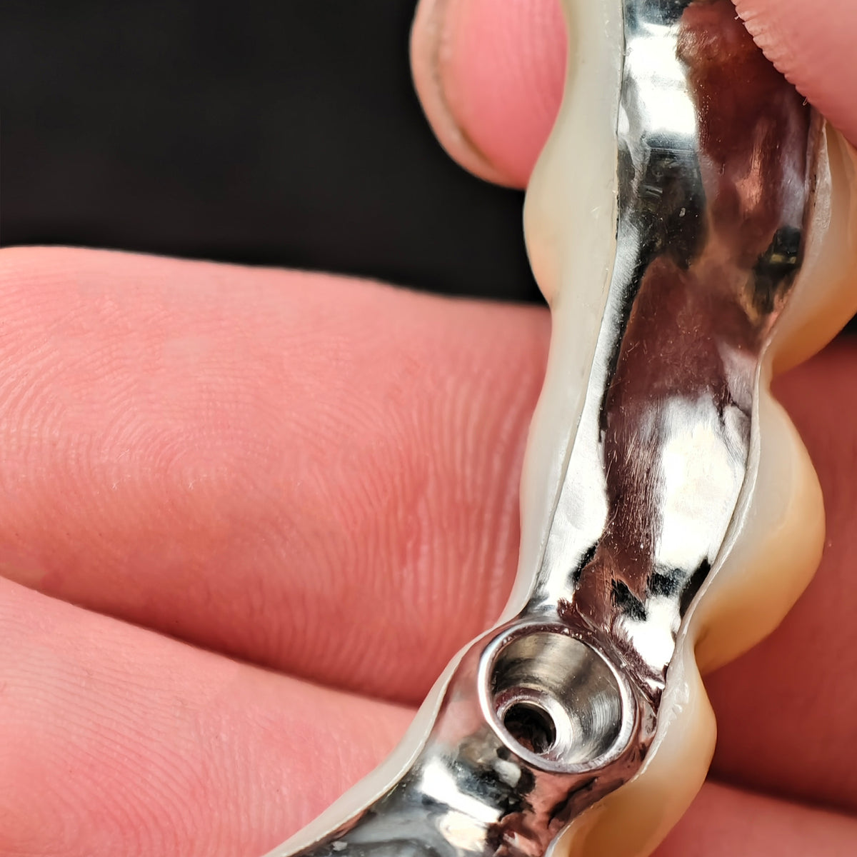 Ti-Bar Pure Titanium Metal Frame With Zirconia Bridge Implant
