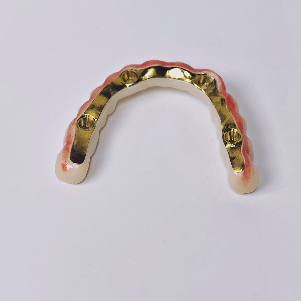 Ti-Bar Titanium Gold-Plated Metal Frame With Zirconia Bridge And Screw Retained