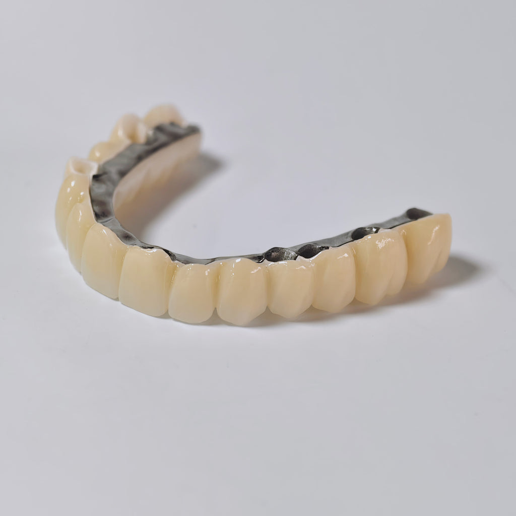 Ti-Bar Titanium Nitride Metal Frame With Zirconia Bridge And Cement Retained
