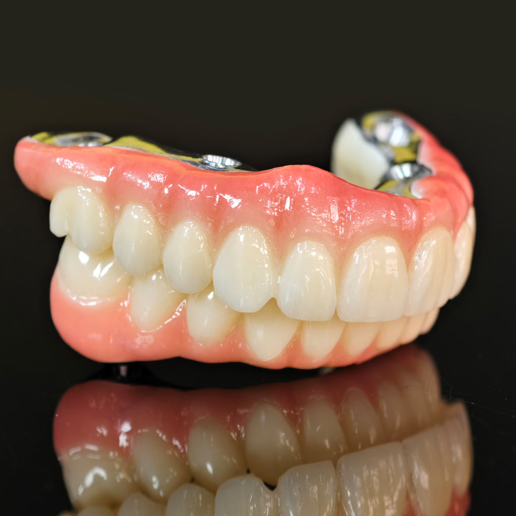 Ti-Bar Titanium Nitride Metal Frame With Zirconia Bridge For Full Arch Restoration