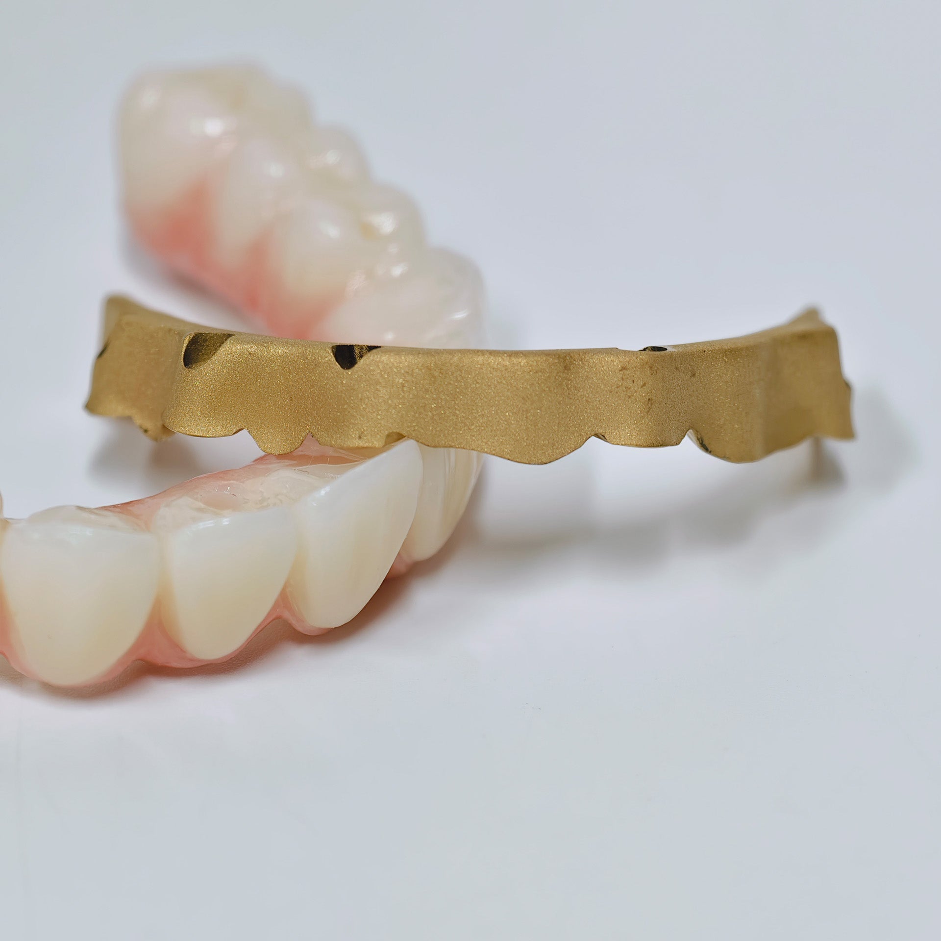 Ti-Bar Titanium Nitride Metal Frame With Zirconia Bridge For Full Arch Restoration