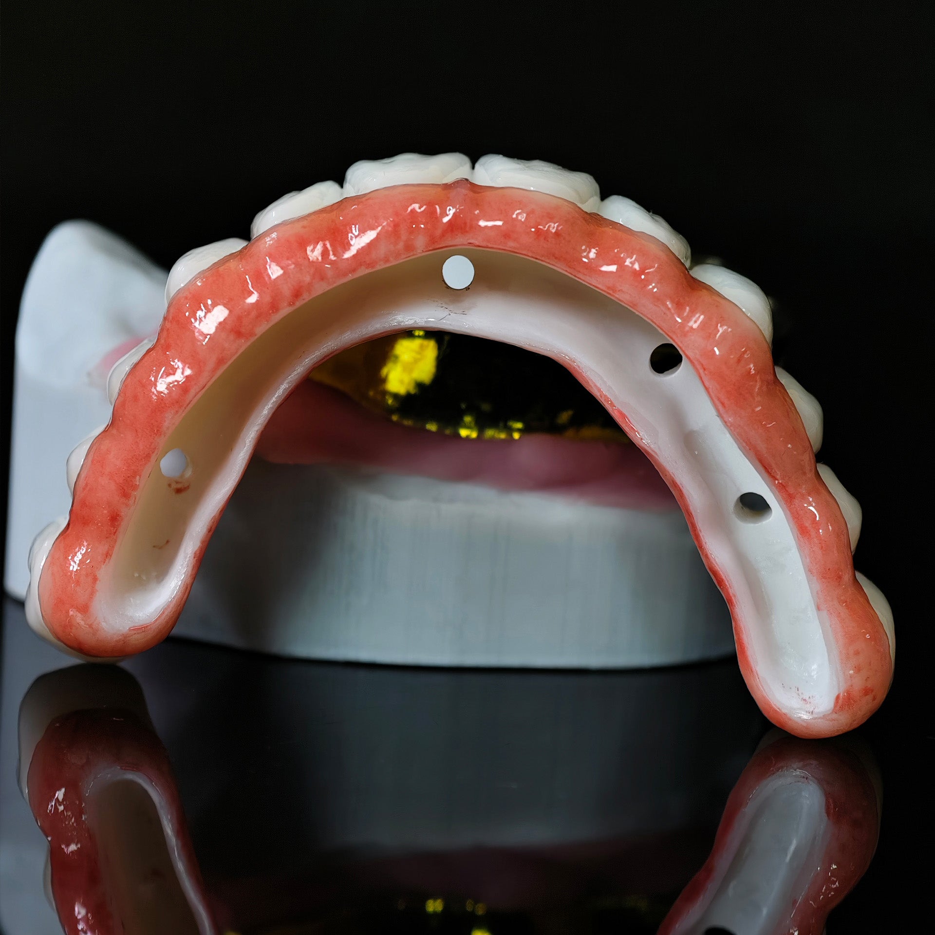 Ti-Bar Titanium Nitride Metal Frame With Zirconia Bridge For Full Arch Restoration