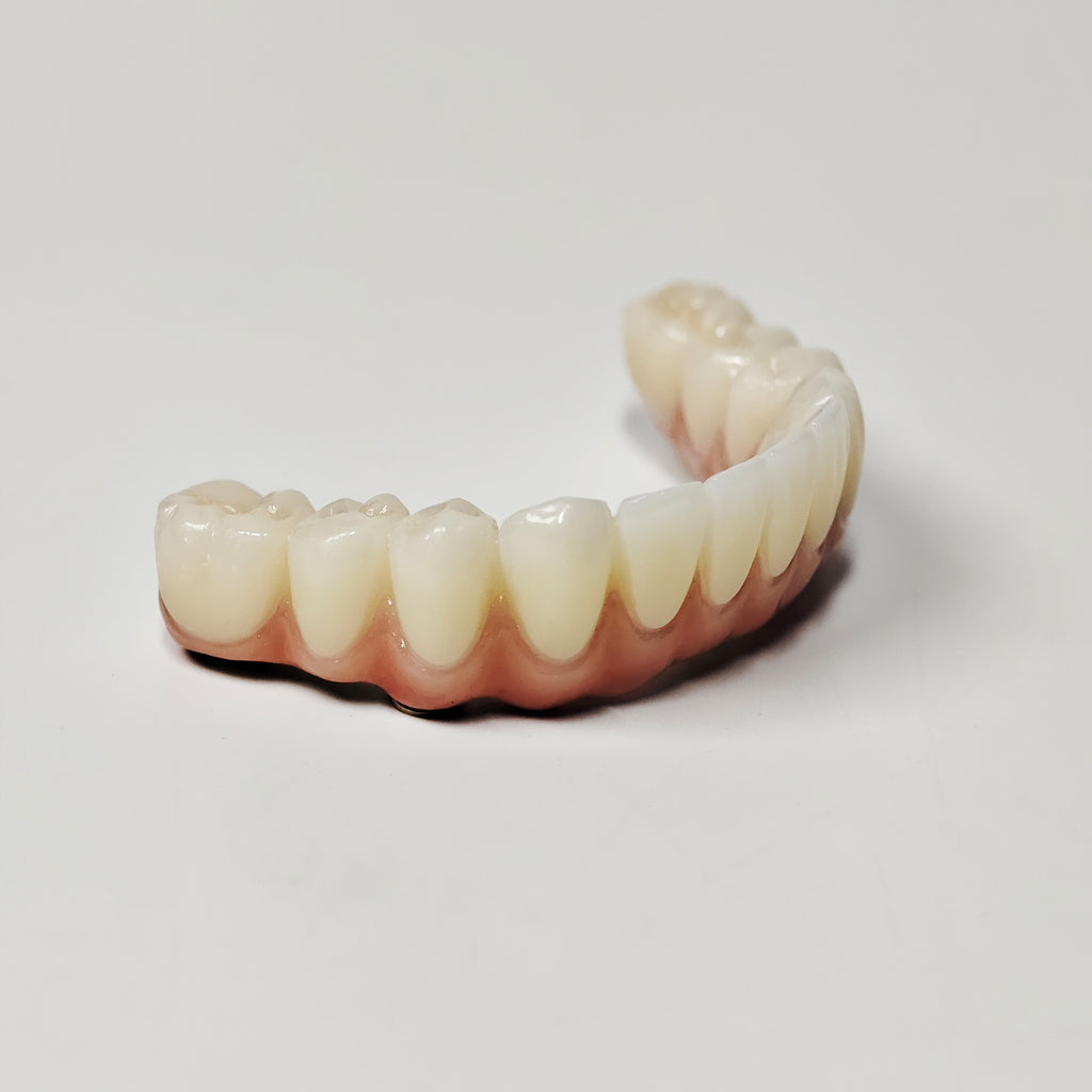 Ti-Bar Titanium Nitride Metal Frame With Zirconia Bridge For Full Arch Restoration
