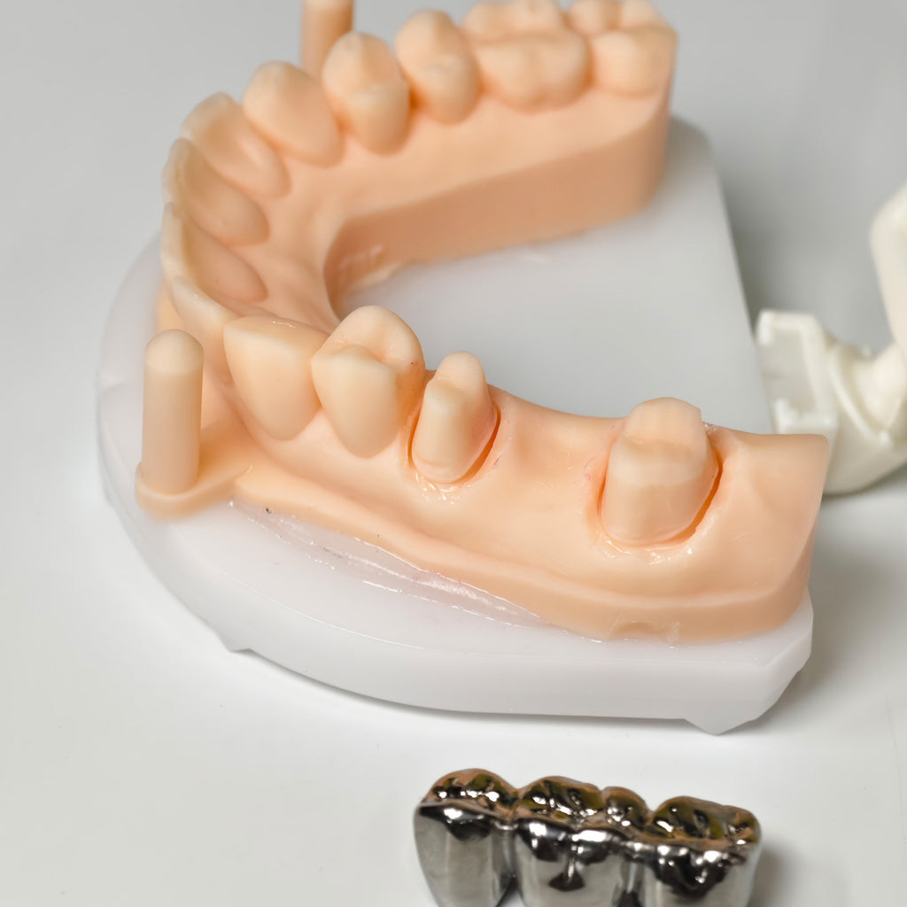 Titanium Crown With Cement Retained