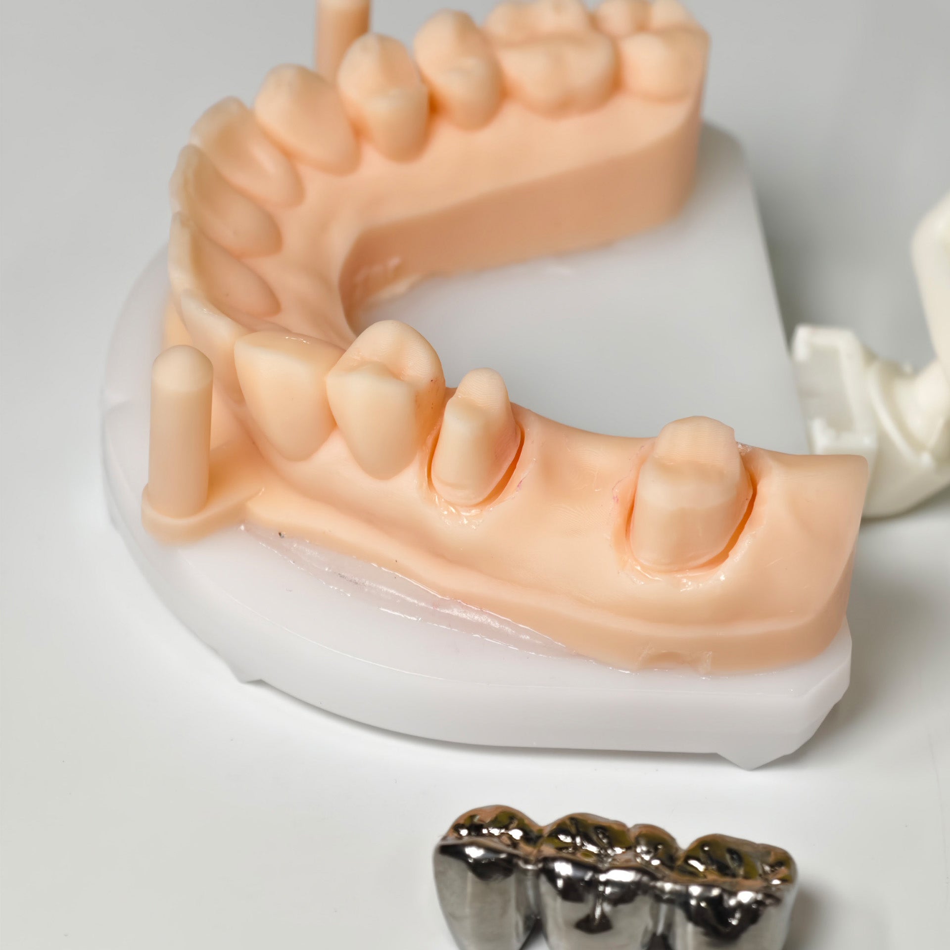 Titanium Crown With Cement Retained