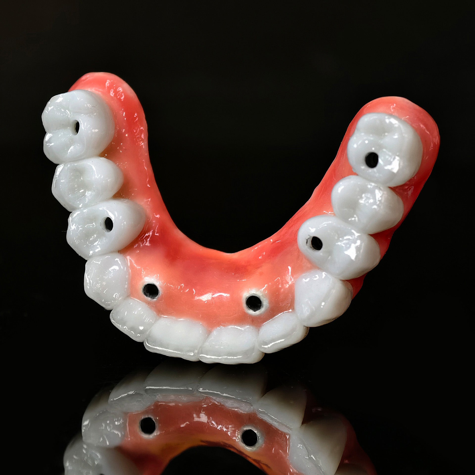 Traditional Malo Bridge With Alloy Framework Covering The Gingiva