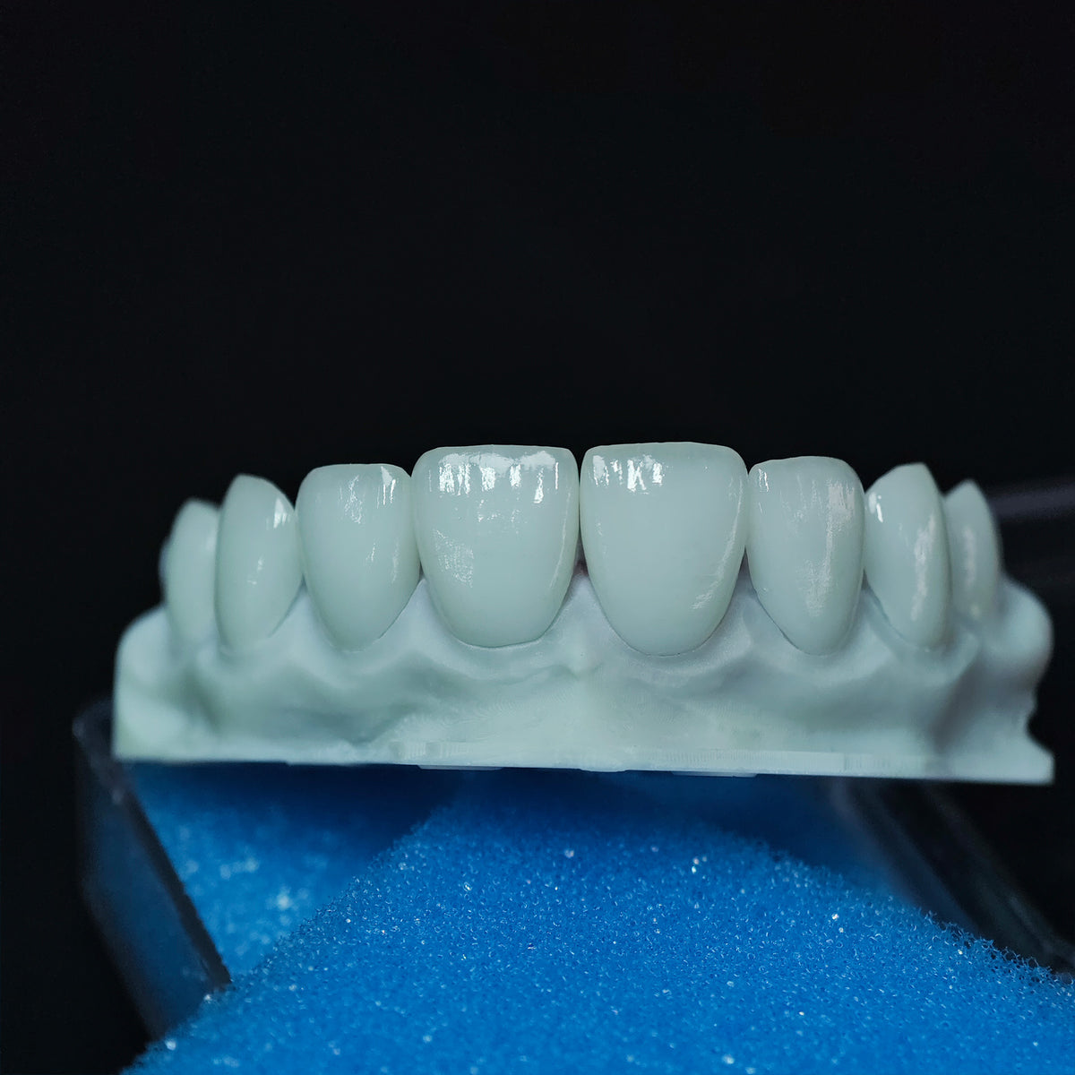 Ultra-Thin Emax Veneer. High Transparency/Translucent, Natural Shade