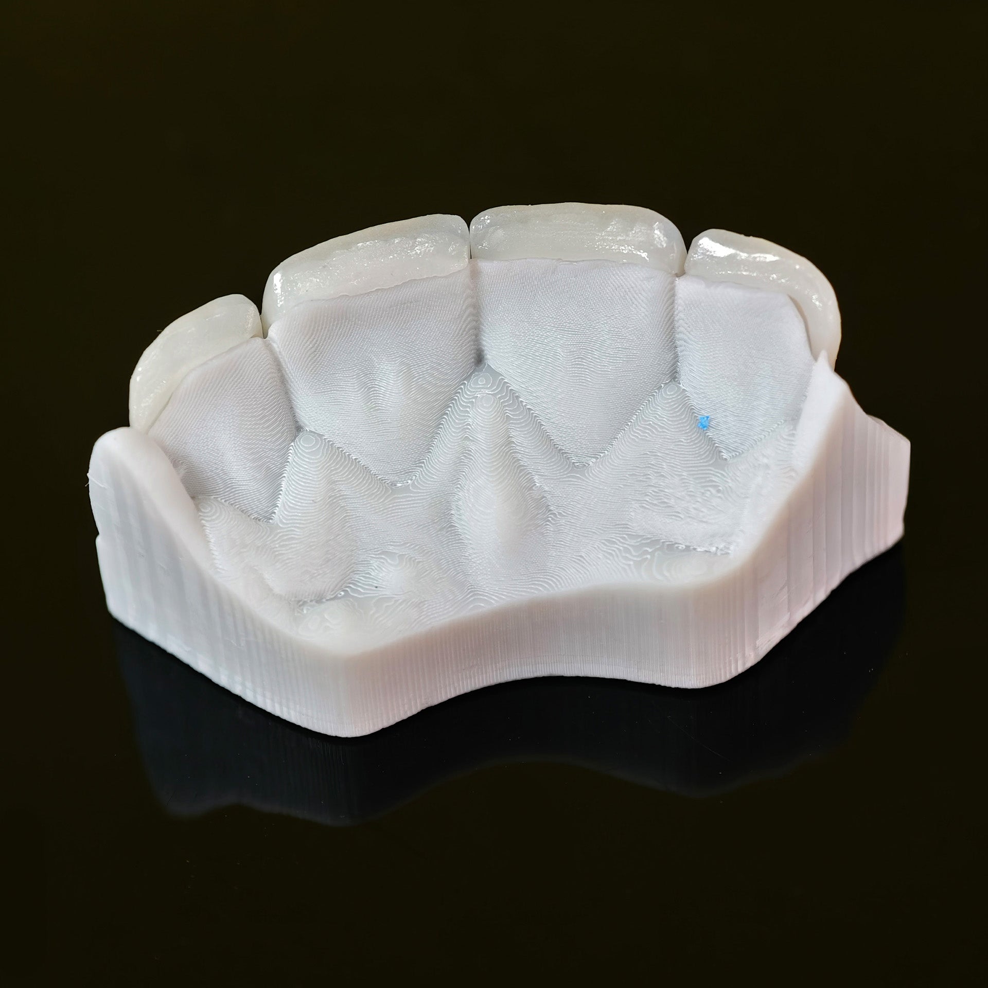 Ultra-Thin Emax Veneer. High Transparency/Translucent, Natural Shade