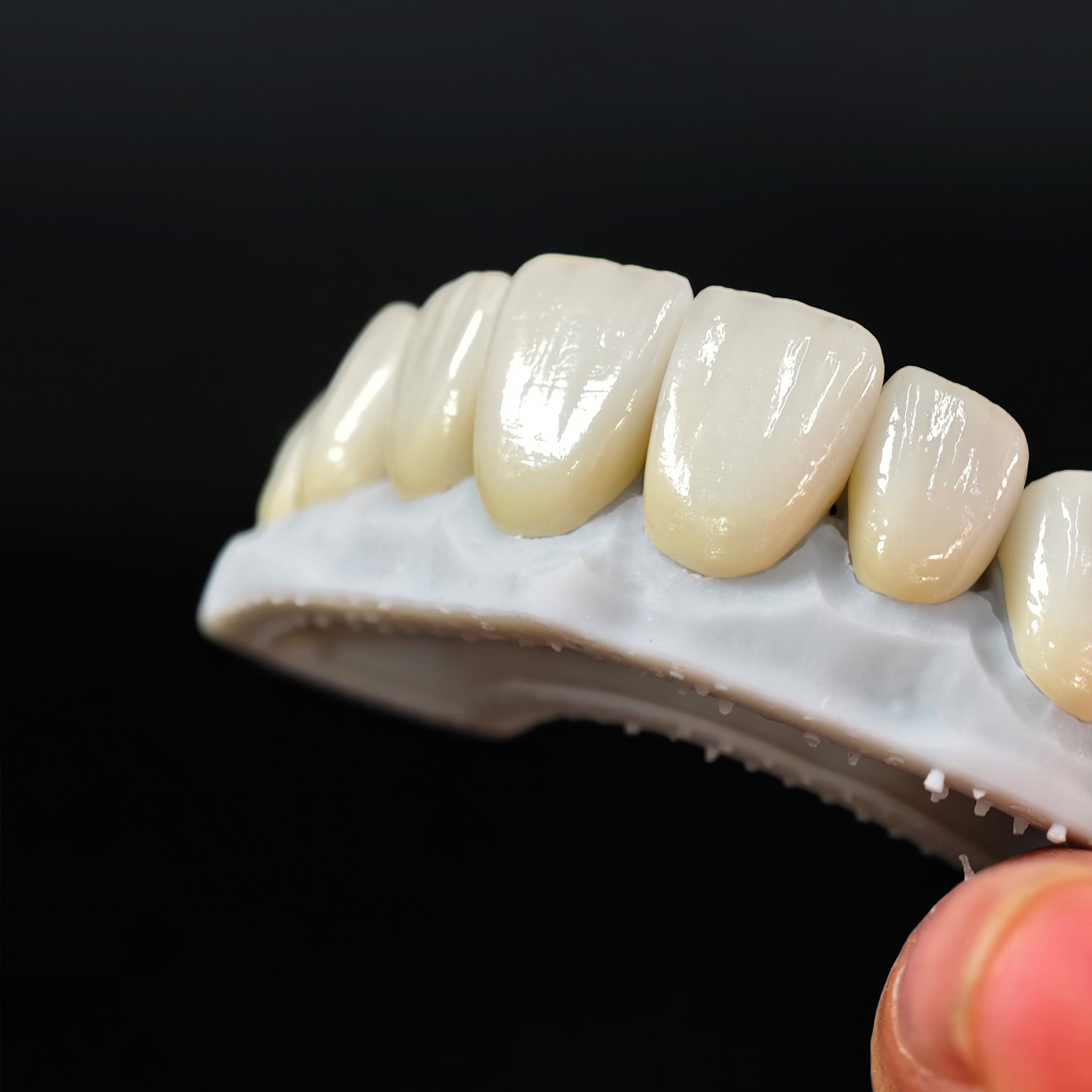 Ultra-Thin Emax Veneer. High Transparency/Translucent, Natural Shade
