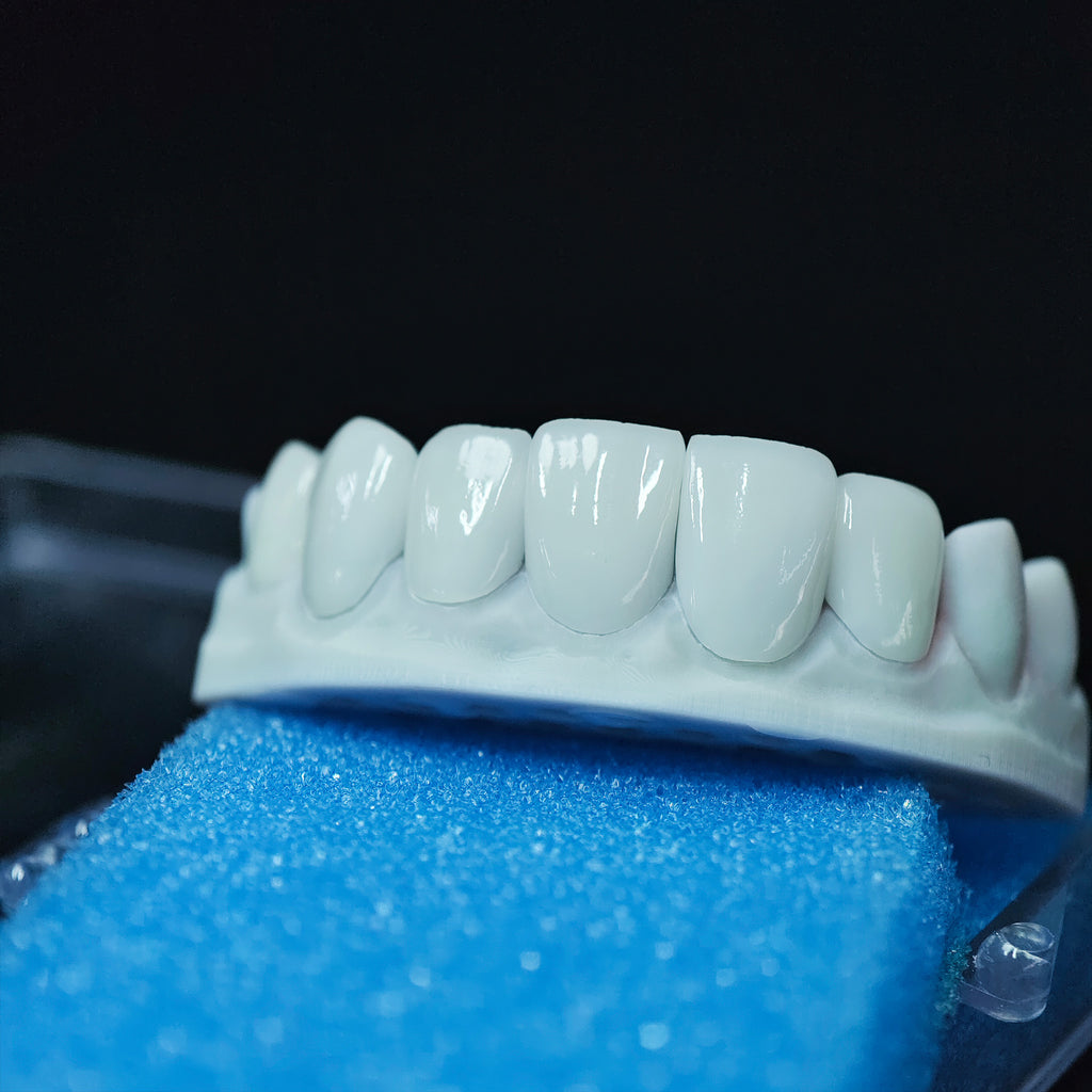 Ultra-Thin Emax Veneer. High Transparency/Translucent, Natural Shade