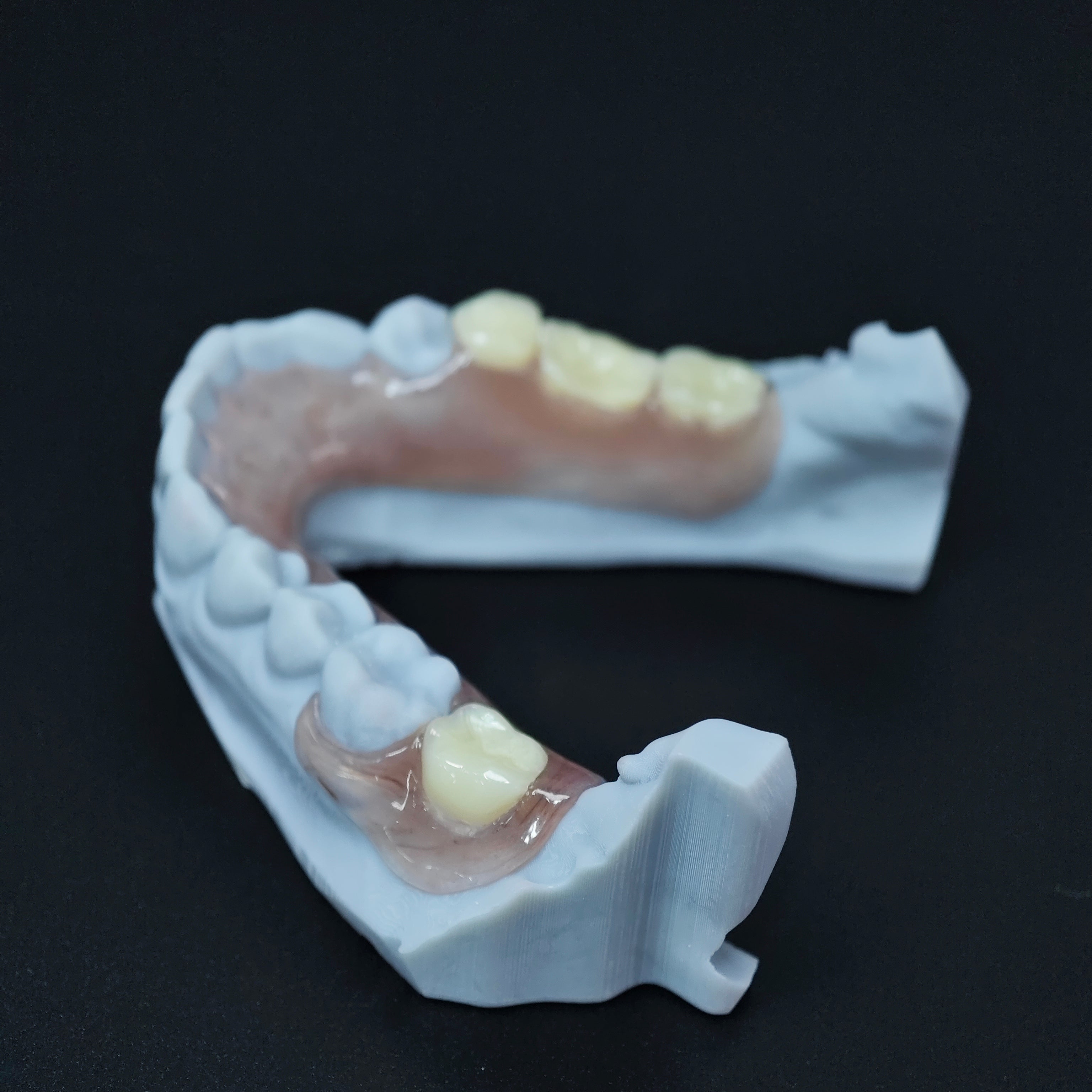 Valplast Denture Beautiful And Elastic Flexible Partial Natural Appearance