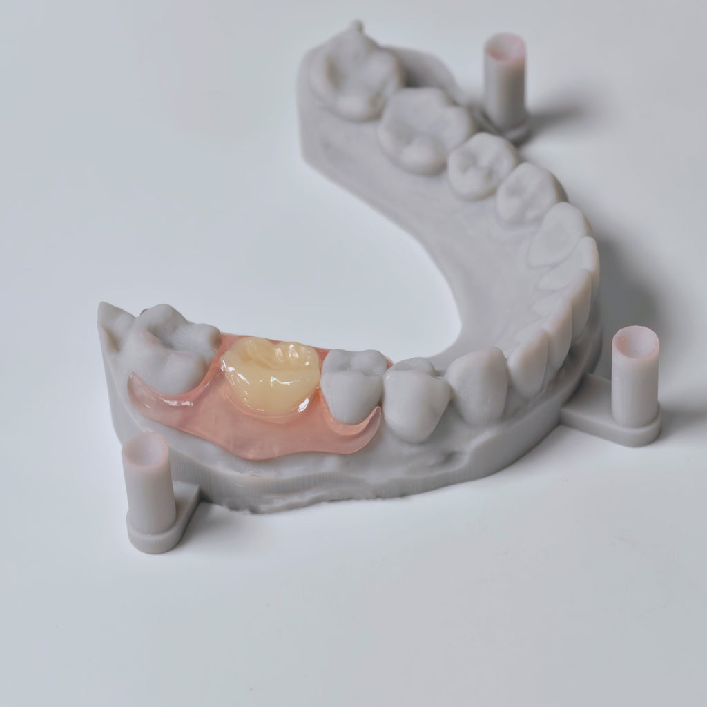 Valplast Denture Beautiful And Elastic Flexible Partial Natural Appearance
