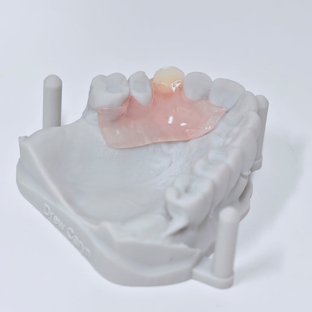 Valplast Denture Beautiful And Elastic Flexible Partial Natural Appearance