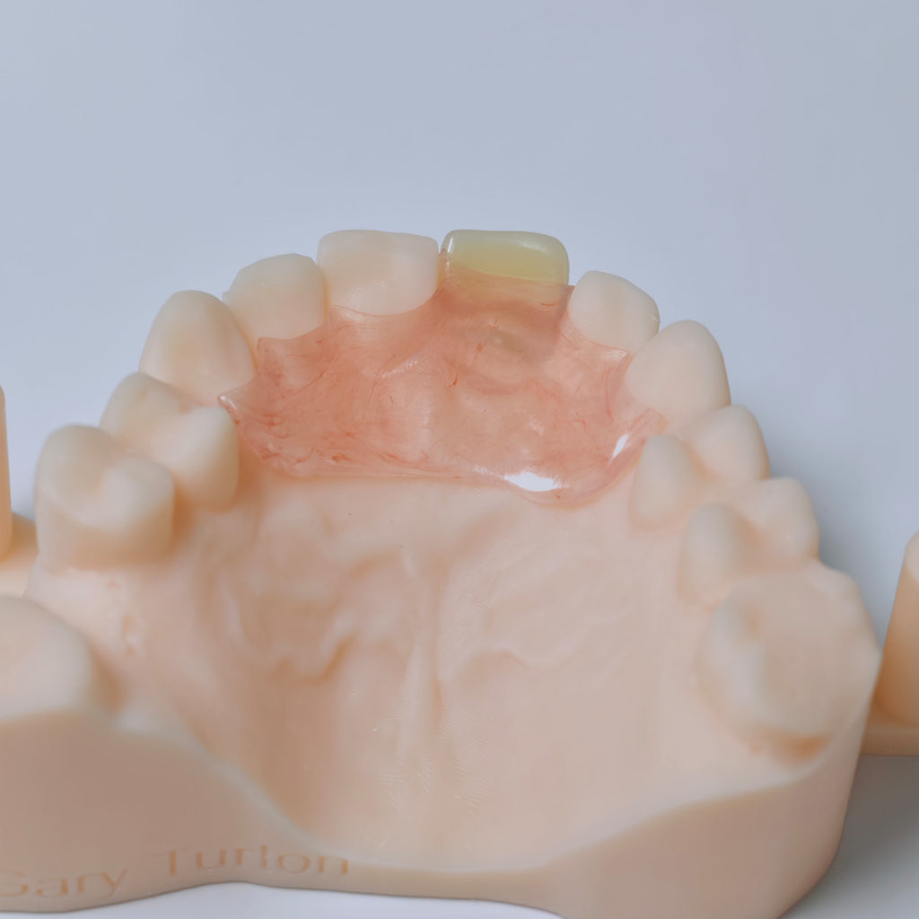 Valplast Denture Beautiful And Elastic Flexible Partial Natural Appearance