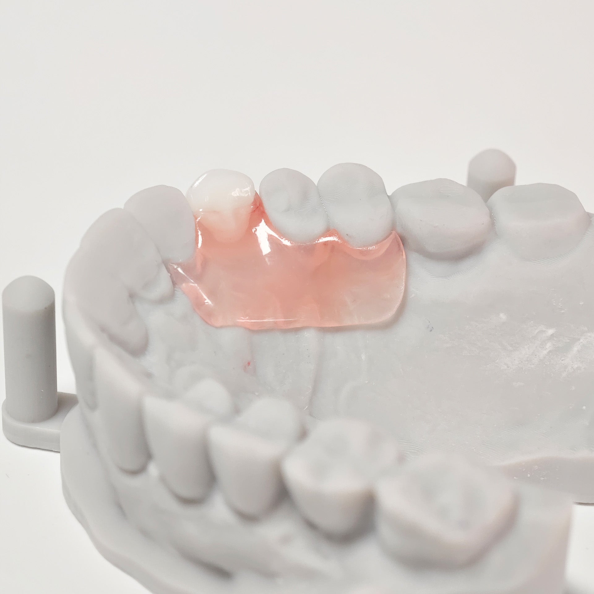 Valplast Denture Beautiful And Elastic Flexible Partial Natural Appearance